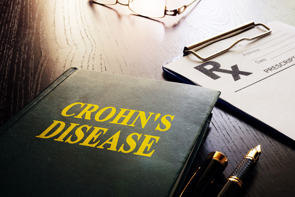 8 early warning signs of Crohn’s that shouldn’t be ignored